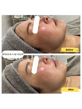 ルビア(Rubia)/ビフォーアフター