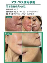 ベイジョ デ アンジョ(Beijo de anjo)/アズイリス