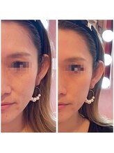 メンズ シンバ(SIMBA)/☆ ビフォーアフター ☆