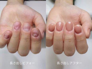 ミンスネイル(Mins Nail)/