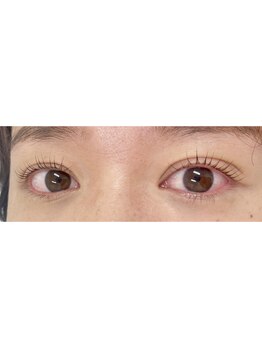 ミネット(Minette)/LASH LIFT