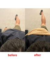 ナオル整体 福岡香椎院(NAORU整体)/40代男性施術事例【股関節】