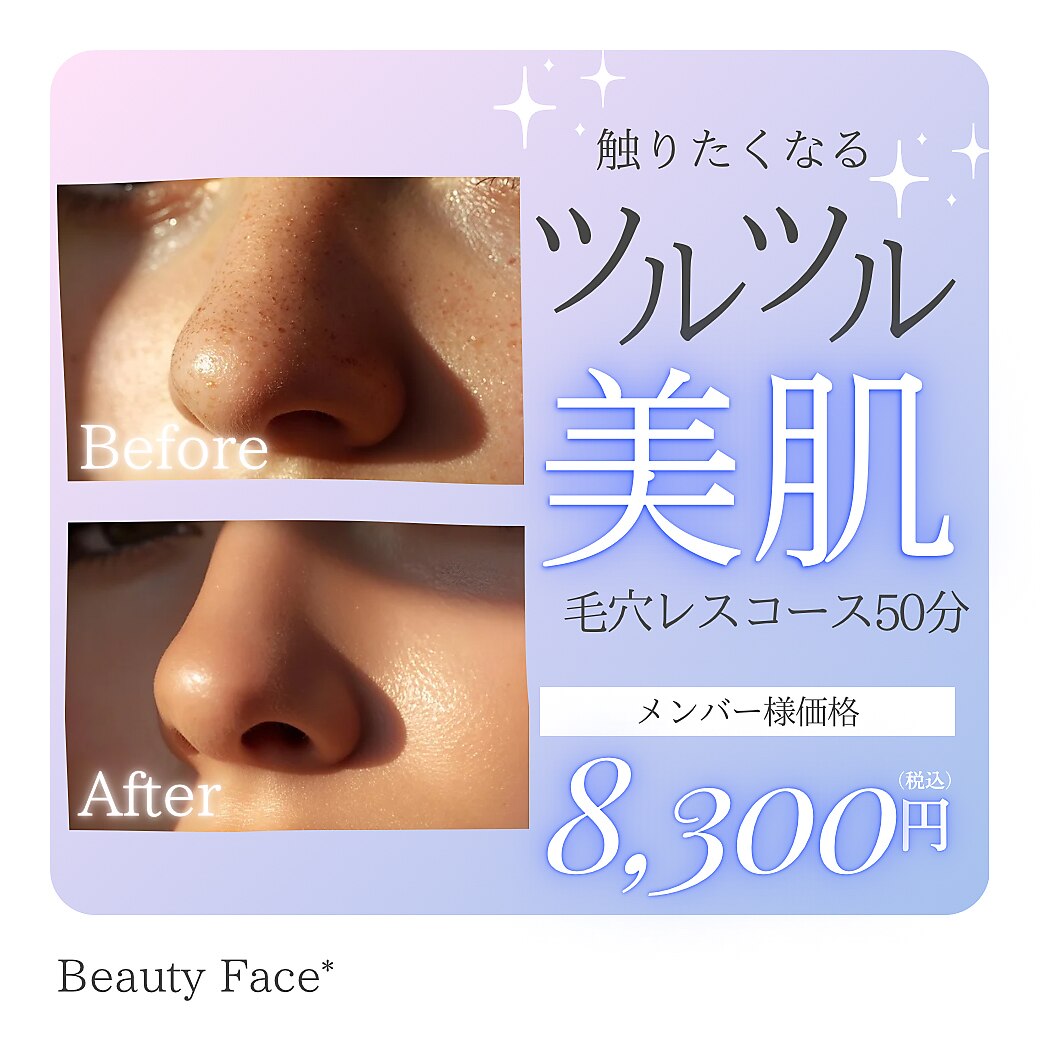 人気NO1!【W洗浄で毛穴の大掃除☆】毛穴レスコース 50分 M￥8500V￥9500