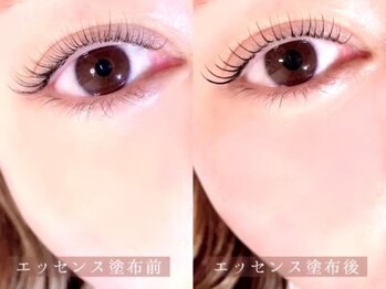 オアラテ 仙台店(or LATTe)/☆アシッドリッチエッセンス☆