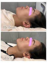 エトア 中目黒(ETOA)/フェイスラインのもたつきに◎