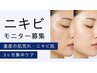 【モニター様募集】ニキビ肌質改善プログラム★￥25,400→￥11,000
