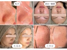 バーガルサロンギンザ(VAGAL SALON GINZA)の雰囲気(ハーブピーリング×美容液導入が好評!1回でも効果を実感♪)