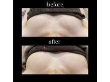 シュバル(CHEVAL)/「BBLバスト」1回目♪