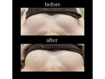 シュバル(CHEVAL)/「BBLバスト」1回目♪