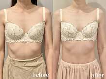 ティアモ(Ti Amo)/Before/After