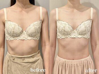 ティアモ(Ti Amo)/Before/After