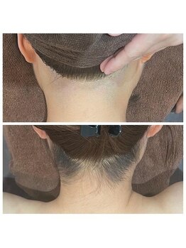 ミース 北九州店/うなじ▲ビフォーアフター