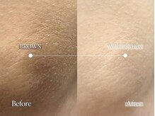 エメ 名古屋栄店(aimer)/LEMELLA <メラニンケア>