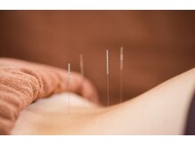 TJMととの鍼灸院の雰囲気（一人ひとりに合わせたオーダーメイド施術で初めてでも◎）