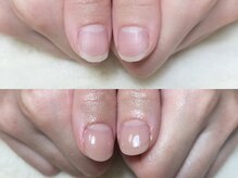 グラシナ なんば店/深爪/自爪育成/フィルイン