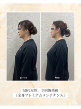 プレメ 人形町院(The Preme)/姿勢矯正