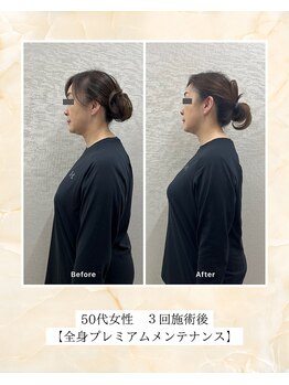 プレメ 人形町院(The Preme)/姿勢矯正