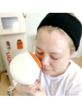 まえかわ鍼灸整骨院の写真/セルフ光フォト￥4,000→2,980！30分お試し価格で気軽にハリツヤケアをはじめよう◎