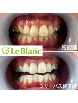 ルブラン 奈良店(Le Blanc)/イベント行事の前に！