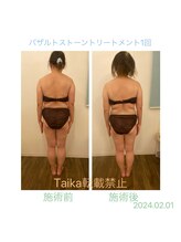 タイカ(Taika)/背中の張りをすっきりと