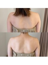 クレン(CLEN)/ブライダルオススメ