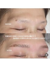 フルアナ(Hu ruana)/ハリウッドブロウリフト