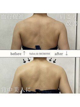 サロンドリシェス(Salon de RICHESSE)/肩こり盛り上がり改善