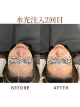 マヴィ くずは店(MavY.)/1回でも実感