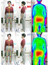 姫路なごみ整体院 なごみ鍼灸院/(改善例)　慢性疲労　倦怠感