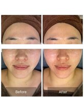 ラペ(la paix)/フェイシャル症例写真