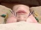 モッチ 天神大名店(MOCCHI)の写真/【国家資格保持者】女性鍼灸師による美容鍼で肌質改善/小顔ケア◎初心者の方も大歓迎/大人女性に大好評☆