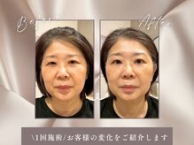 ハリーネ(HARINE)の雰囲気（顔筋膜リリースリンパドレナージュで、たるみ改善！小顔効果♪）