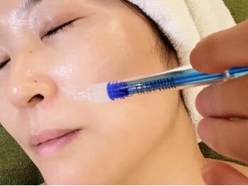 ルミエール フォレストサイド(L’MIERE forestside)の写真/くっきりほうれい線に◎《大反響NEW☆マイクロニードルケア》衰え肌を程よく刺激し自発的に細胞活性化！