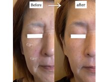 メナードフェイシャルサロン 本通り/