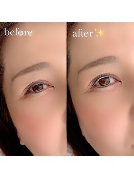 イチマルゴ ガーデン(105 GARDEN)/ラッシュリフト