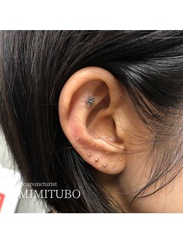 加島鍼灸接骨院/耳つぼジュエリー