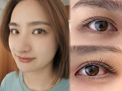 ネストアイ(NEST eye)の写真