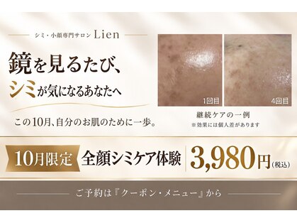 リアンの写真