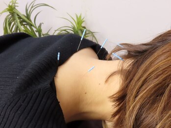 アサヒナ指圧鍼灸院 筋膜リリース研究所/鍼施術/肩こり/首こり/頭痛