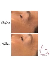 ウルエッテ(UluEtte)/