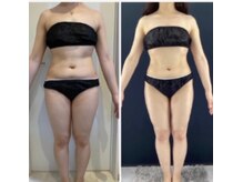 アンピュール(an pur)/BODYの効果シルエット若々しく◎