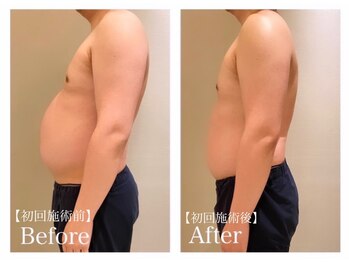 ククナ(KUKUNA)/*姿勢矯正*