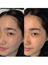 マナ ワクシング 海浜幕張(Mana waxing)/ツヤ肌wax/フェイシャルwax/幕張