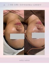 ソルティ サロン(salty salon)/シルクスキン