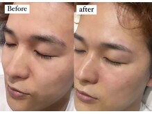 サムライビューティー 新宿三丁目店(SamuraiBeauty)/優しいモテ眉毛