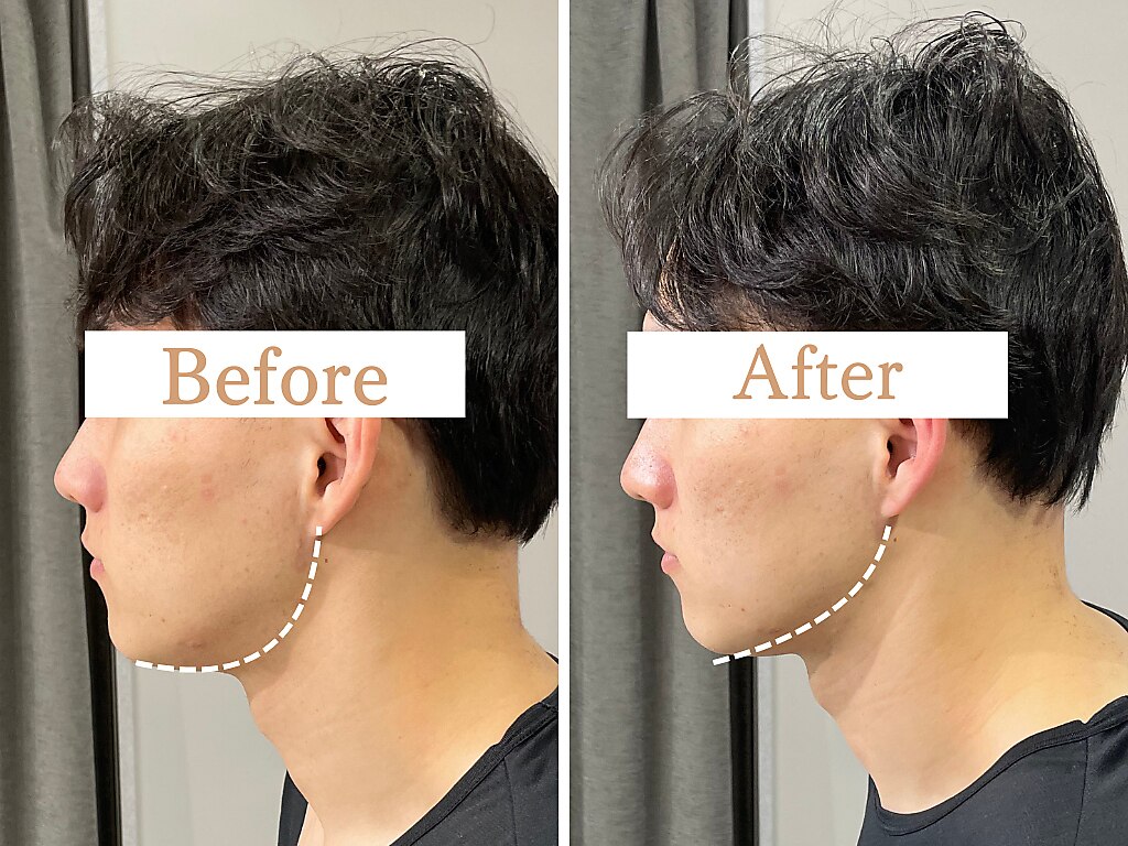 フローフシ∞｜ホットペッパービューティー