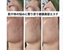 ルビーサロン(ruby-salon)/