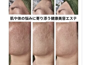 ルビーサロン(ruby-salon)/