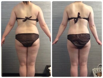 美容整体ウェリナ あま甚目寺院/小顔矯正/骨盤矯正/美脚サロン