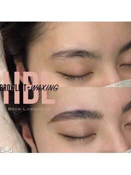 エリス(ELISSE)/ハリウッドブロウリフト